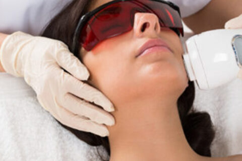 Laser Hair removal treatment being performed on a women