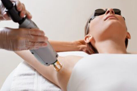 Laser Hair removal treatment being performed on a women