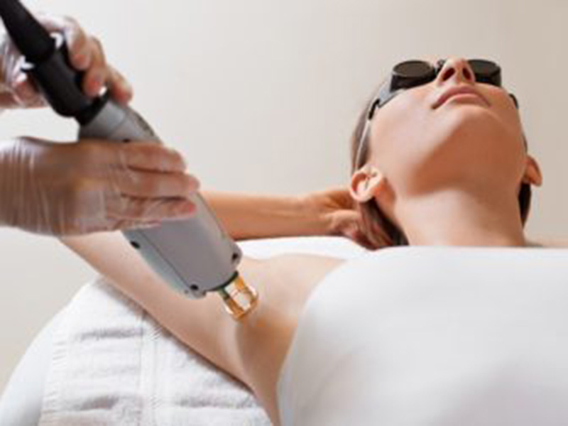 Laser Hair removal treatment being performed on a women