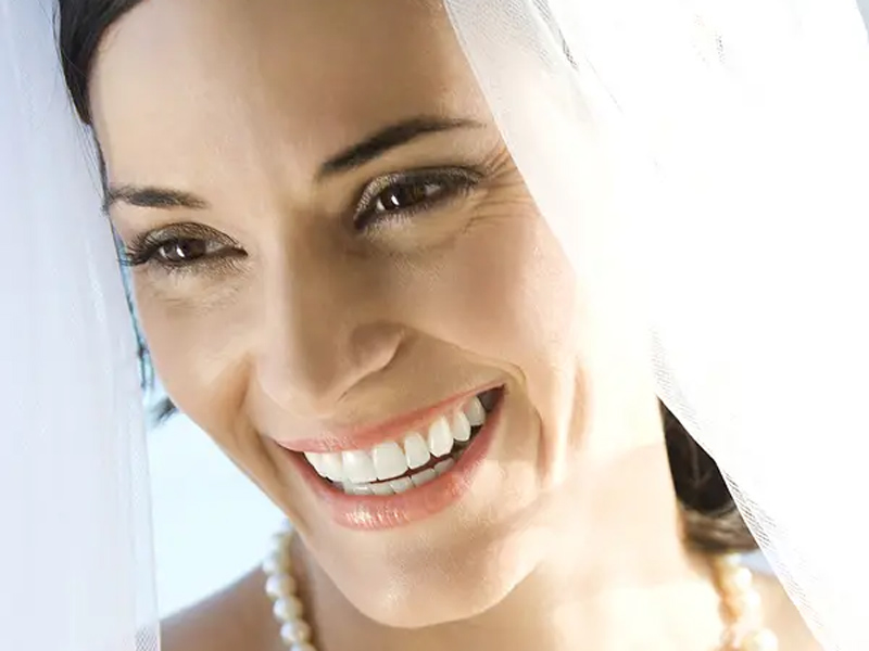 Women smiling with showing teeth