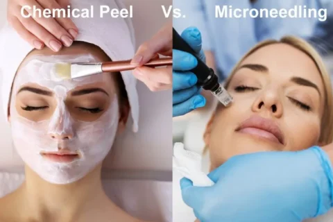 Microneedling vs. Chemical Peels: Which Is Best for Your Skin Type?