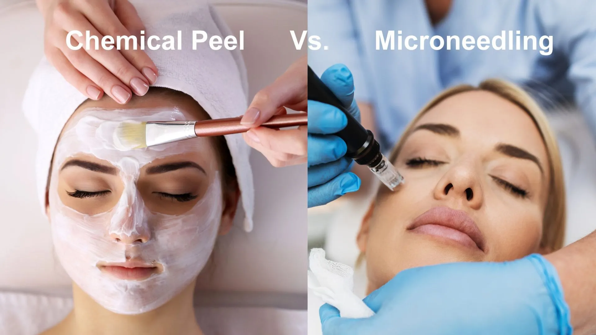 Microneedling vs. Chemical Peels: Which Is Best for Your Skin Type?