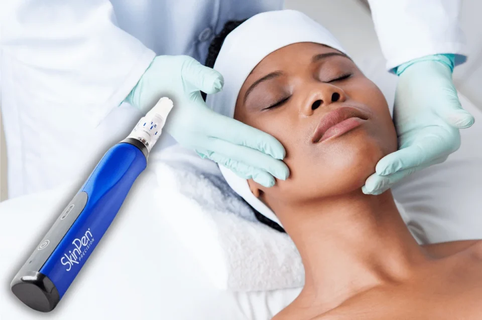 Microneedling vs. Chemical Peels: Key Differences
