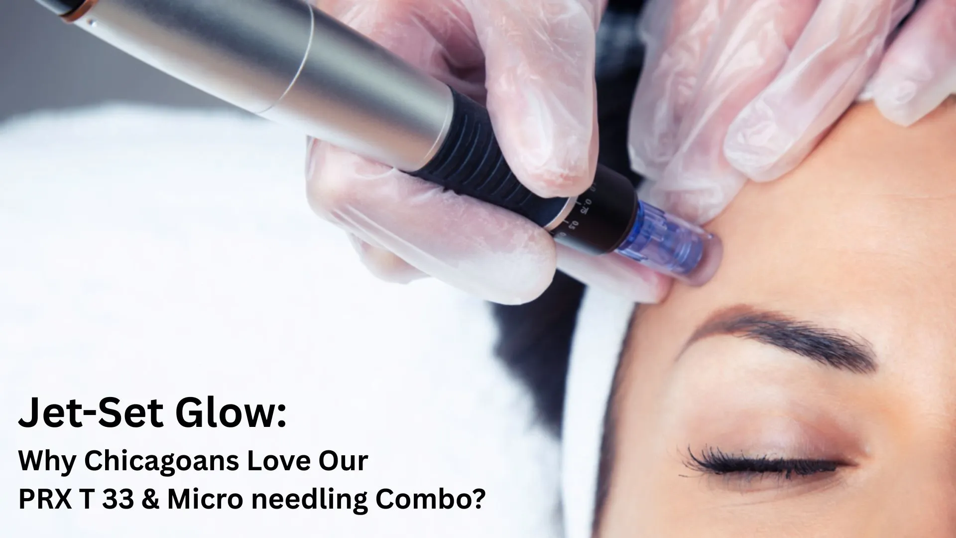 Jet-Set Glow: Why Chicagoans Love Our PRX T 33 & Micro needling Combo