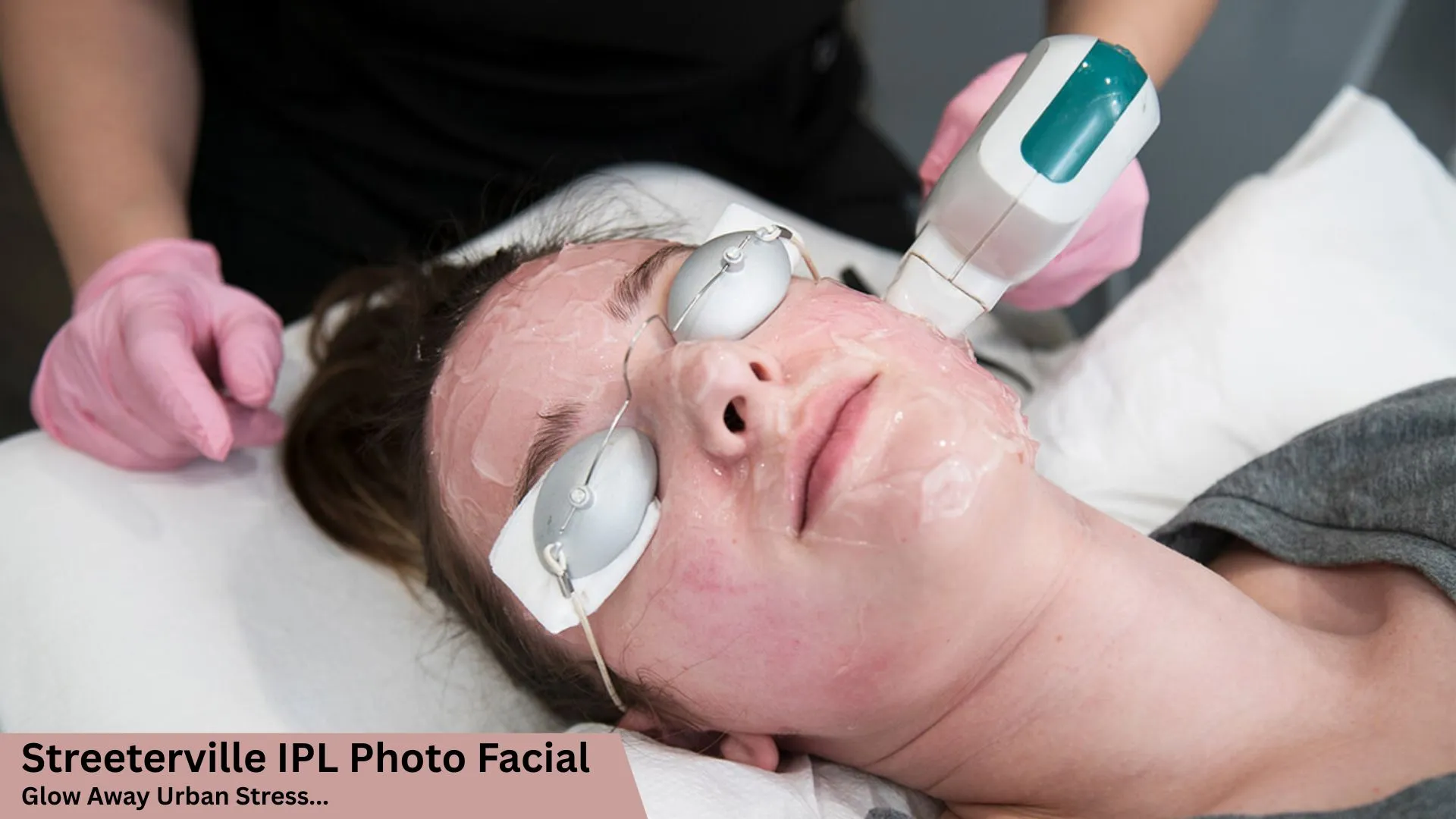 Streeterville IPL Photo Facial: Glow Away Urban Stress