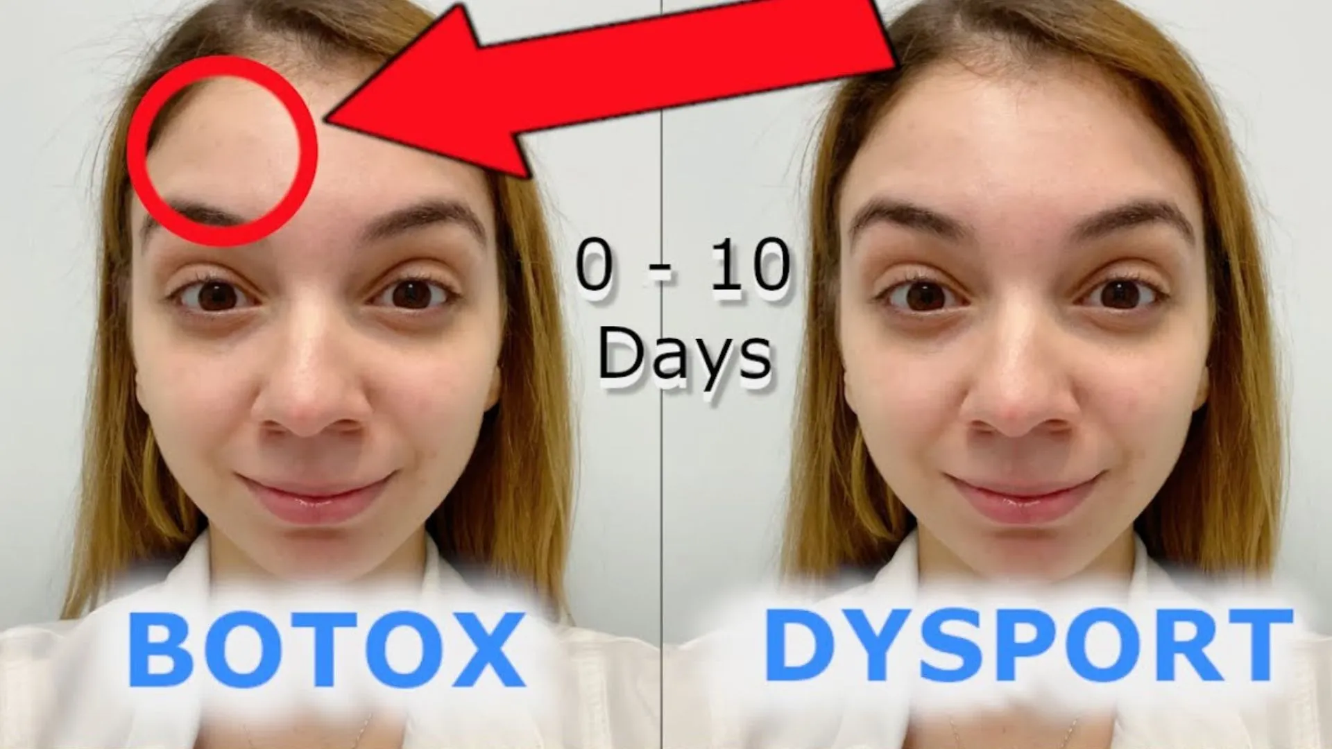 Botox vs Dysport in Chicago: Which Suits Your Lifestyle at Gold Coast Med Spa?