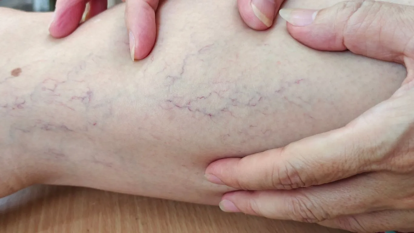How Many Treatments Will I Need?
