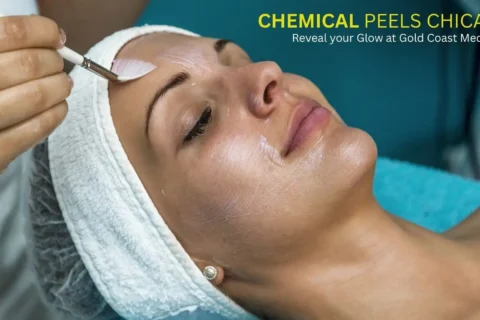 Reveal Your Glow: The Ultimate Guide to Chemical Peel in Chicago