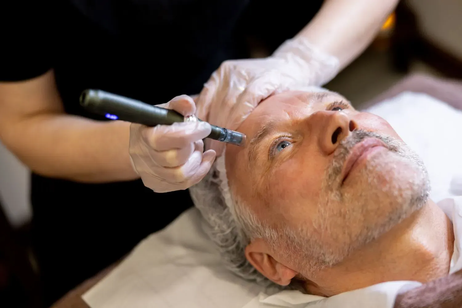 Microneedling Services at Gold Coast Med Spa