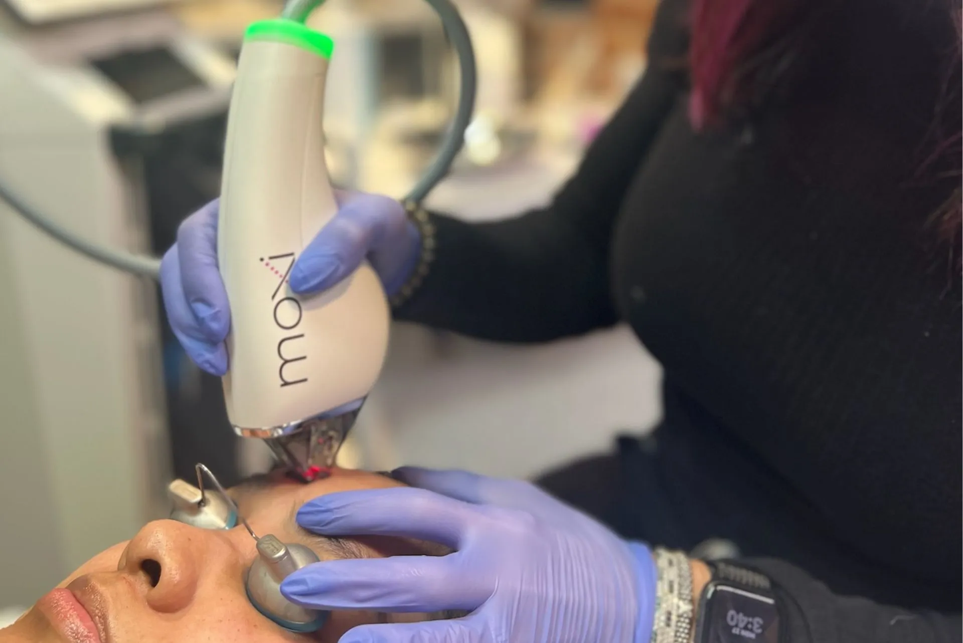 Why Choose Gold Coast Med Spa for Laser Hair Removal in Chicago?