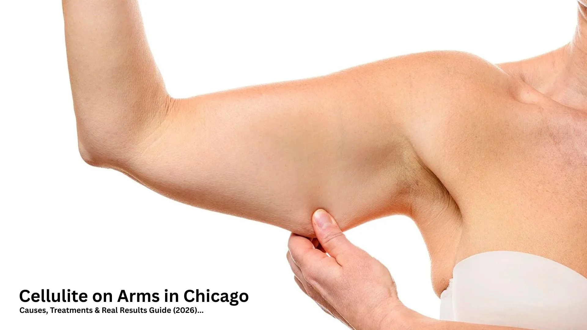 Cellulite on Arms in Chicago: Causes, Treatments & Real Results Guide (2026) Cellulite on Arms in Chicago Causes, Treatments & Real Results Guide (2026)