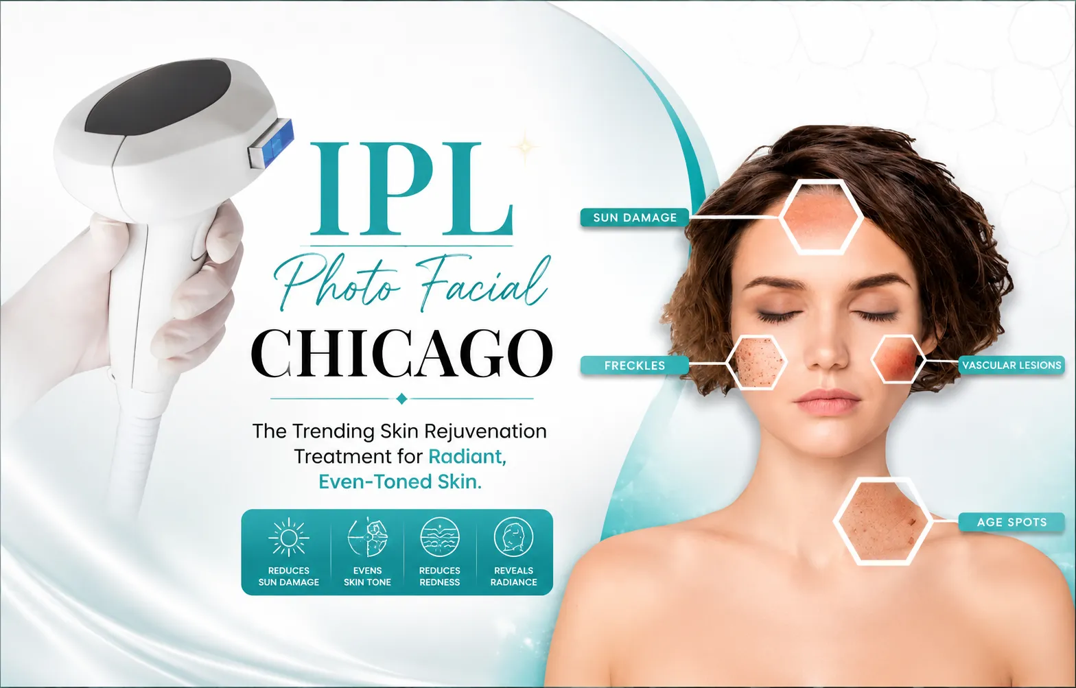 IPL Photo Facial Chicago 2026