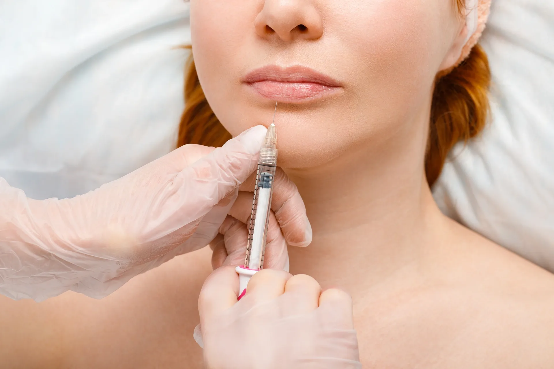 Benefits of Lip Injections Benefits of Lip Injections
